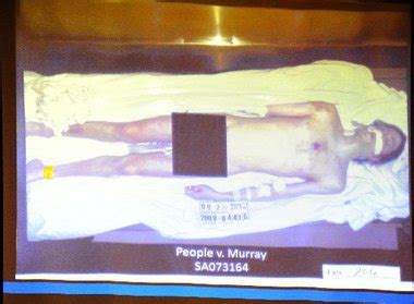 michael jackson autopsy photo|Jurors shown shocking Michael Jackson autopsy photos